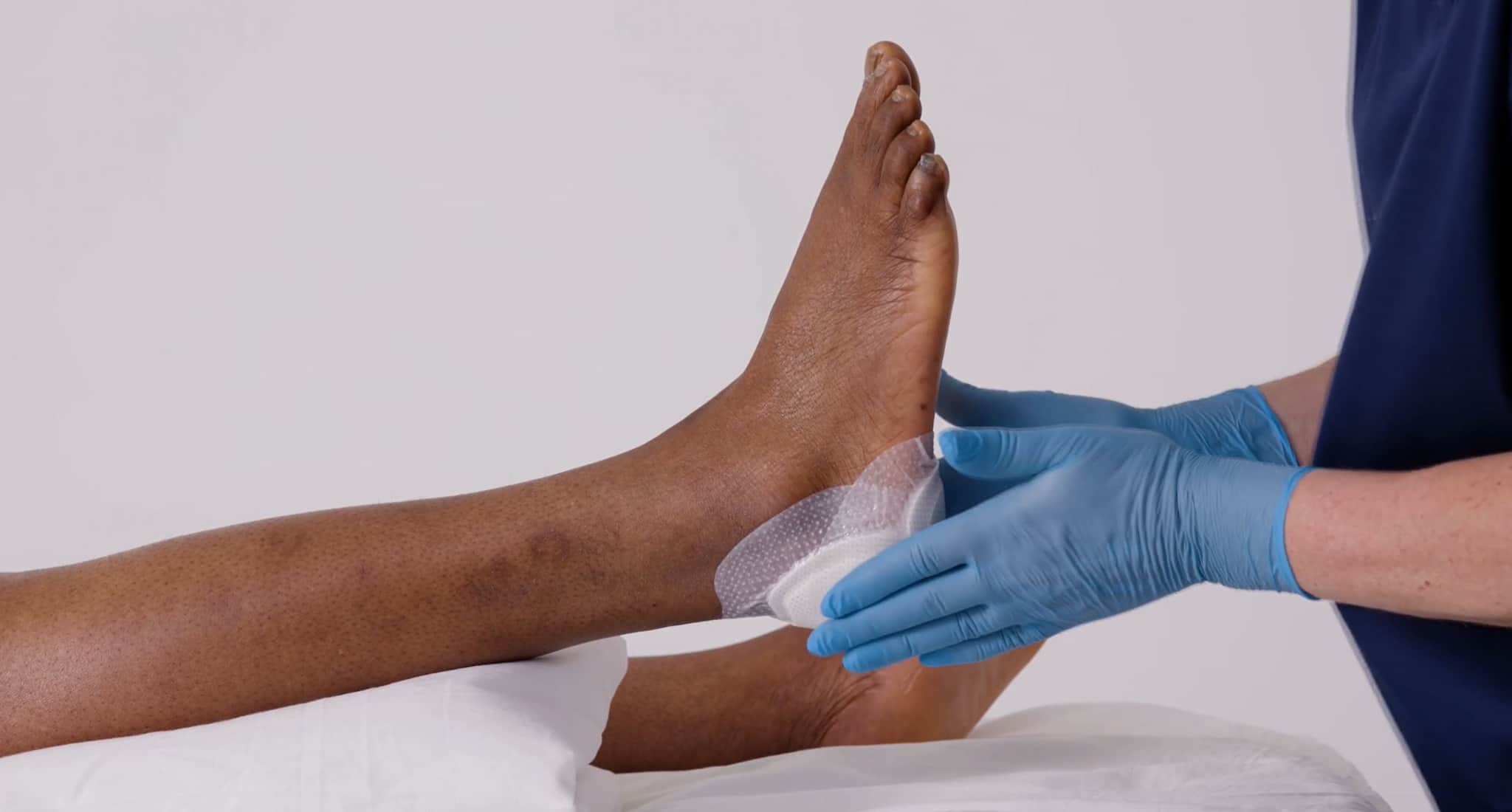 Applikationsvideo Biatain® Silicone Ferse