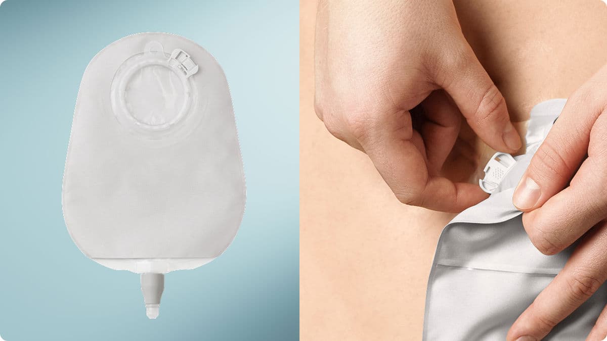 Zweiteiliges Bild mit SenSura Mio Urostomiebeutel links und Hand, die den Beutel mit Klick-Kopplung verschließt rechts