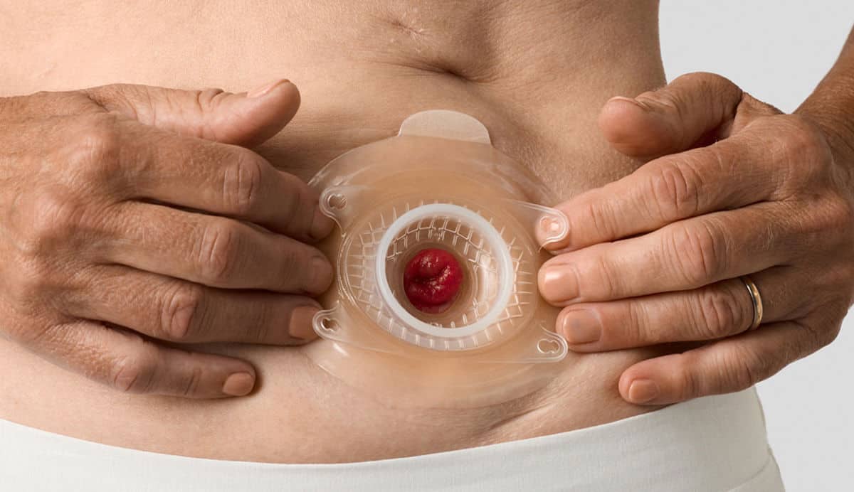 Person platziert konvexe Basisplatte am Bauch und streicht über Seiten