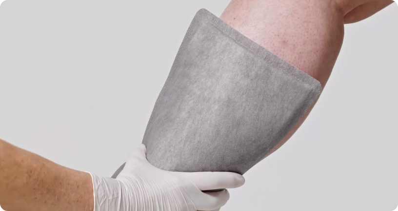 Applikation des superabsorbierenden Wundverbandes - Größe: 20 cm x 25 cm