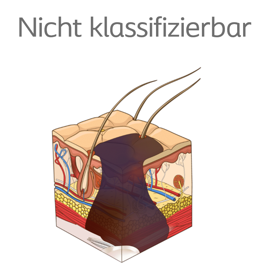 Dekubitus nicht klassifizierbar