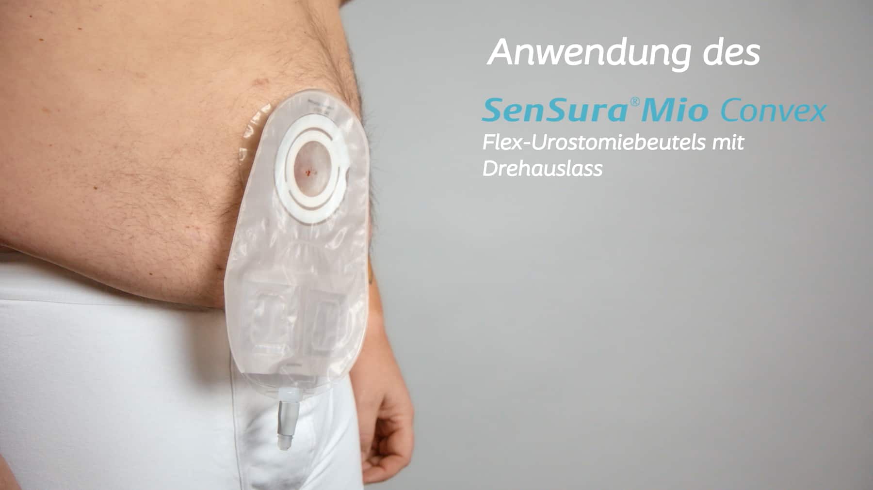 Anwendung SenSura Mio Convex Flex | Urostomieversorgung