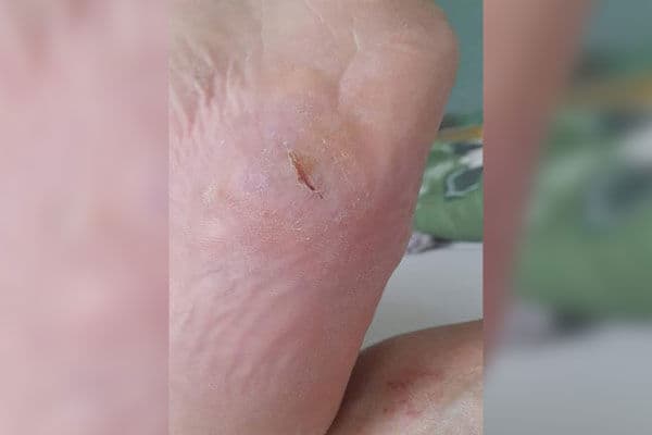 DFS Monat 3