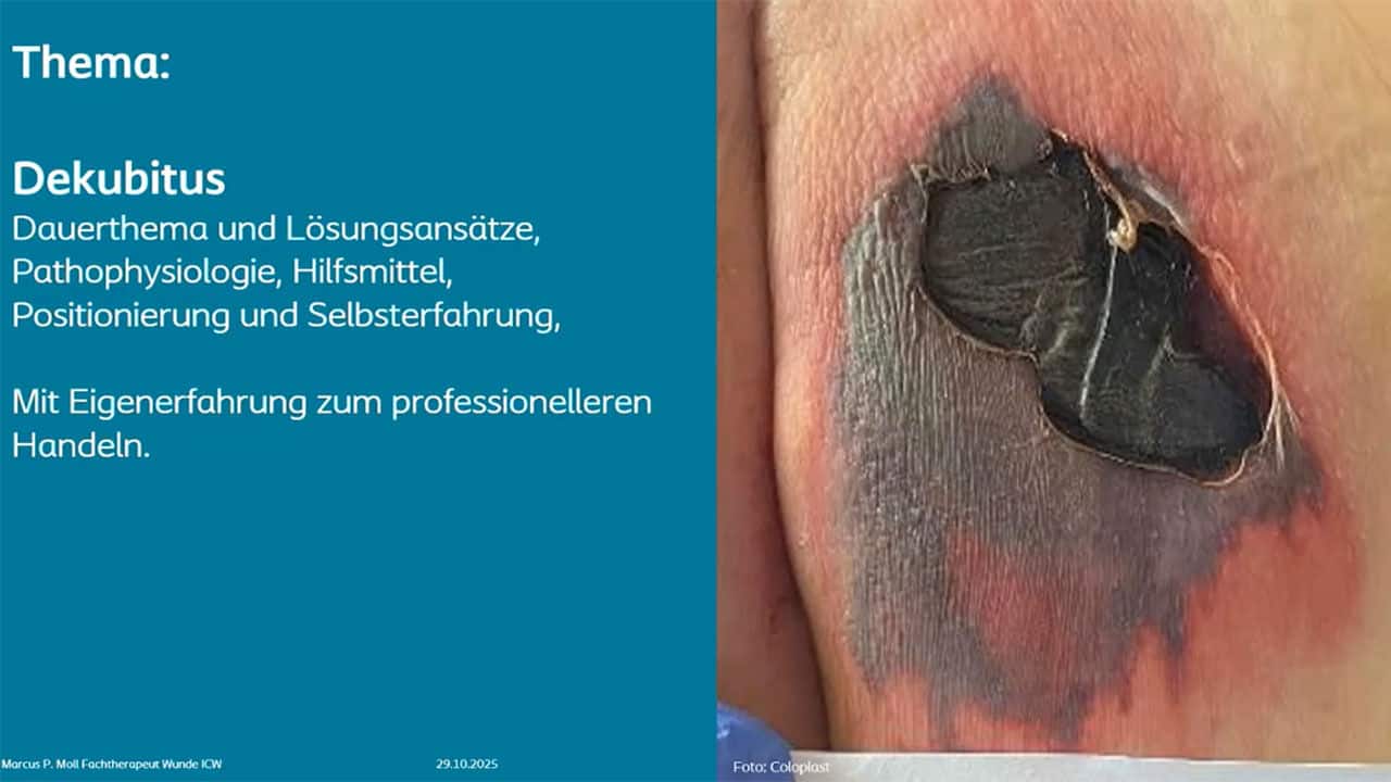 Teaser: Dekubitus muss nicht sein – Prävention und Behandlung