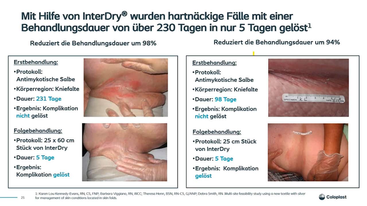 Augen auf: Intertrigo oder IAD